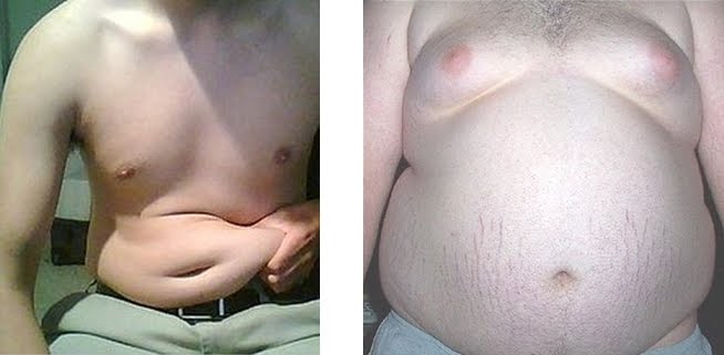 Subcutaneous versus Visceral fat (photo on the right)
